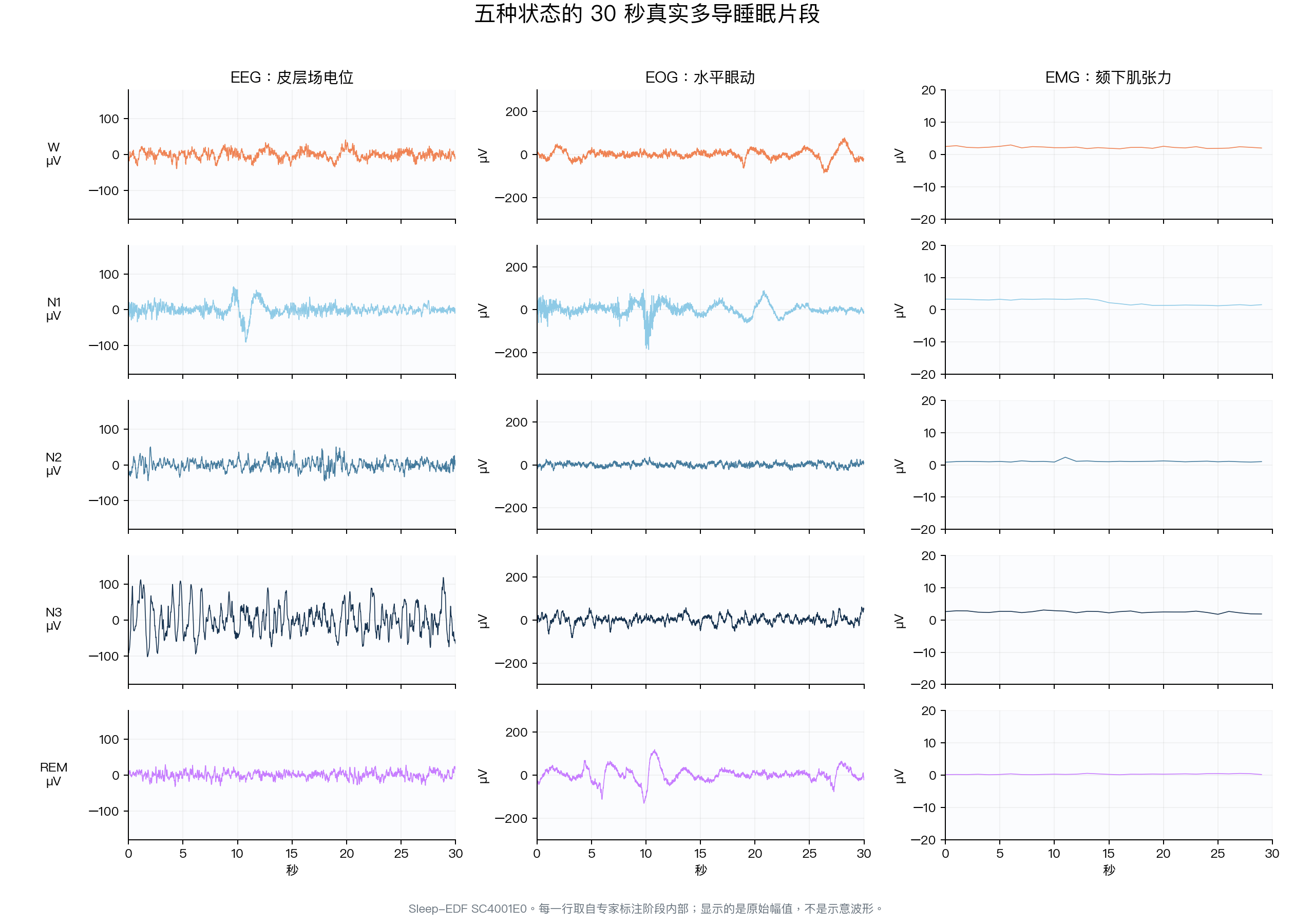 清醒、N1、N2、N3和REM的真实EEG EOG EMG信号